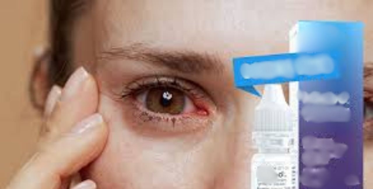 What Is Miebo and Why Does It Matter for Dry Eyes?